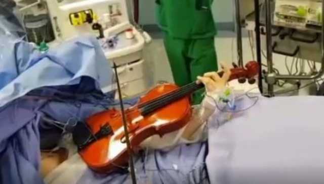 Violino Operazione