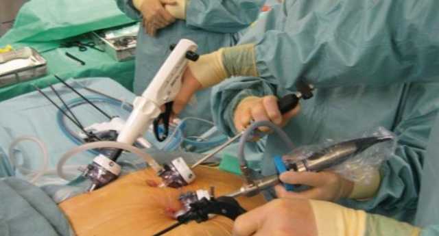 Intervento Chirurgico Stomaco