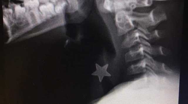 Stela Metallo Tagliata