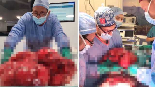 Photo 6050973402799393537 Y