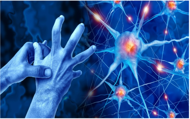 Parkinson Tecnologia