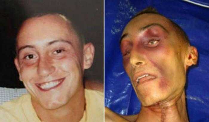 Stefano-Cucchi-picchiato