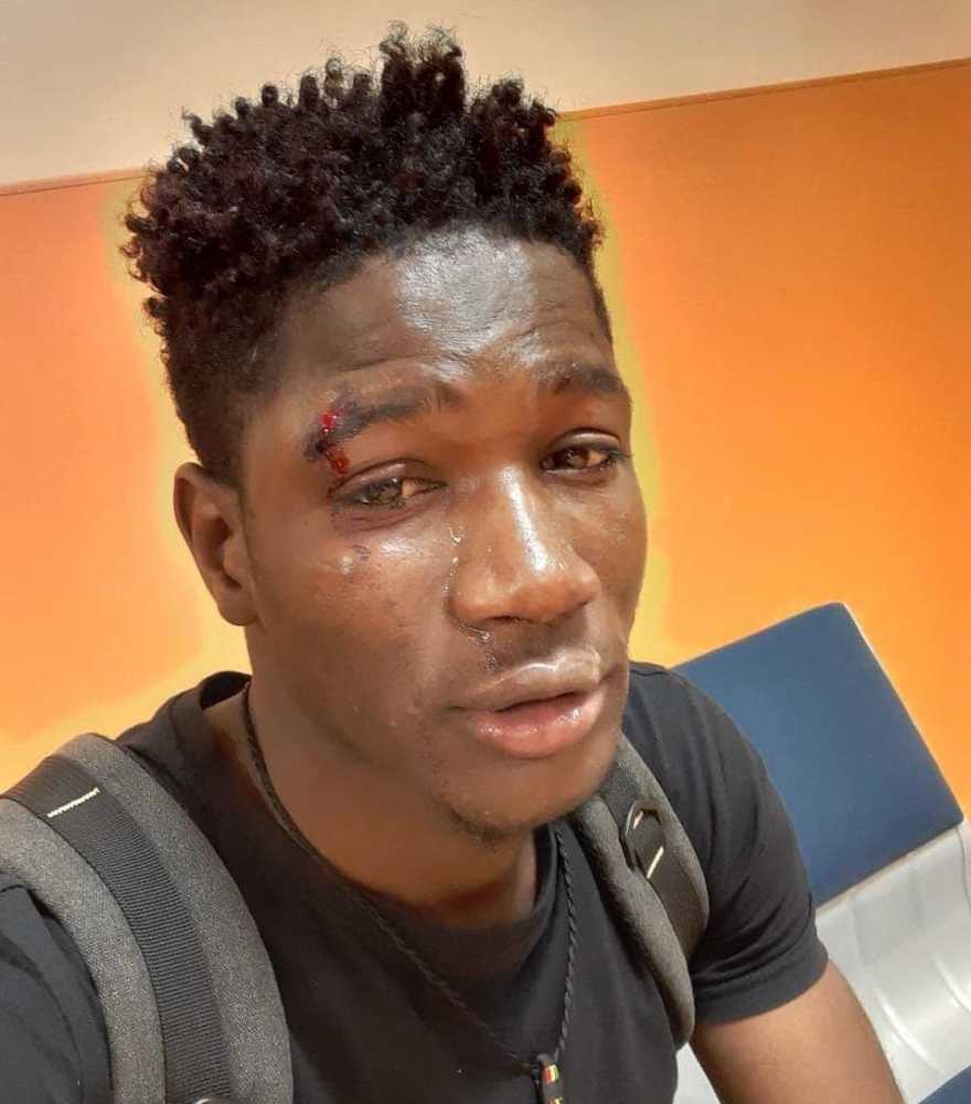 Senegalese-picchiato