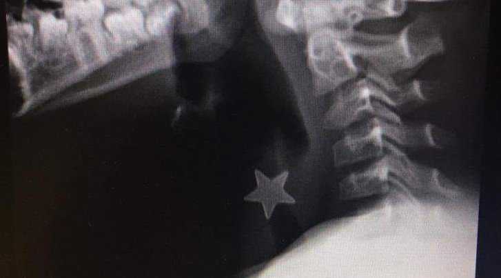 Stela-metallo-tagliata