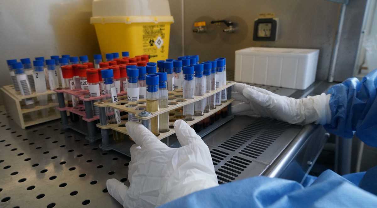 Prostituta-positiva-al-covid