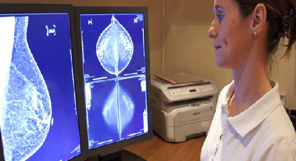 MAMMOGRAFIA-IMMAGINE-SIMBOLO