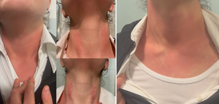 aggressione-dottoressa