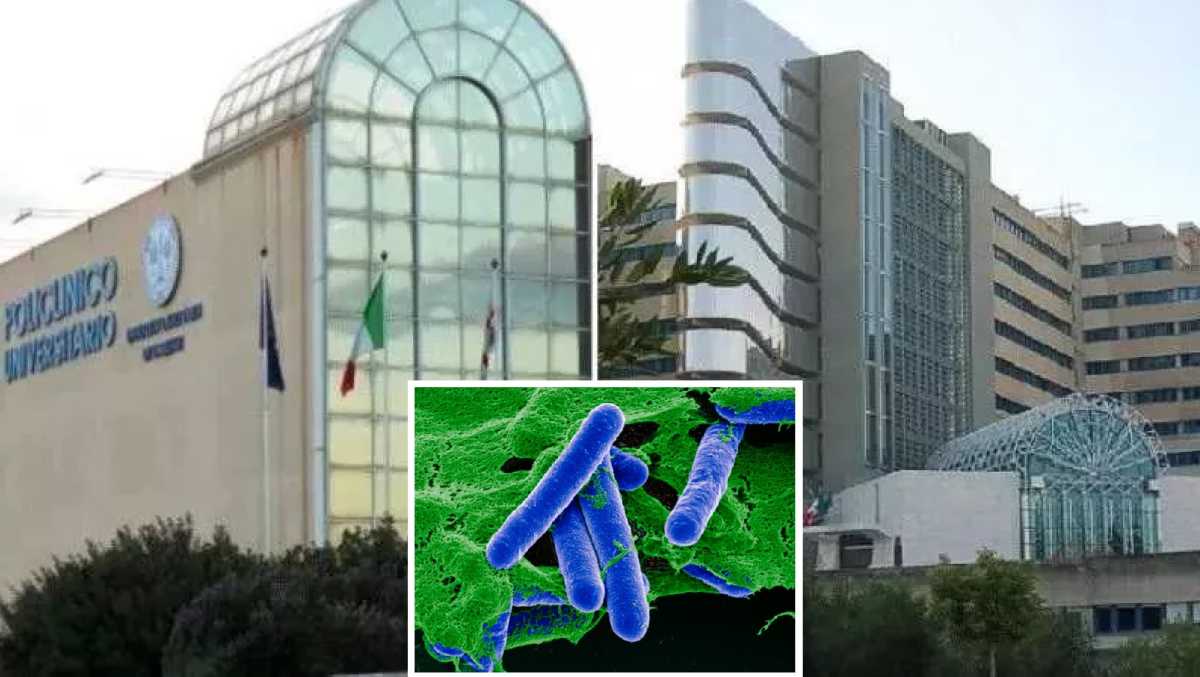 Botulino-Brotzu-policlinico