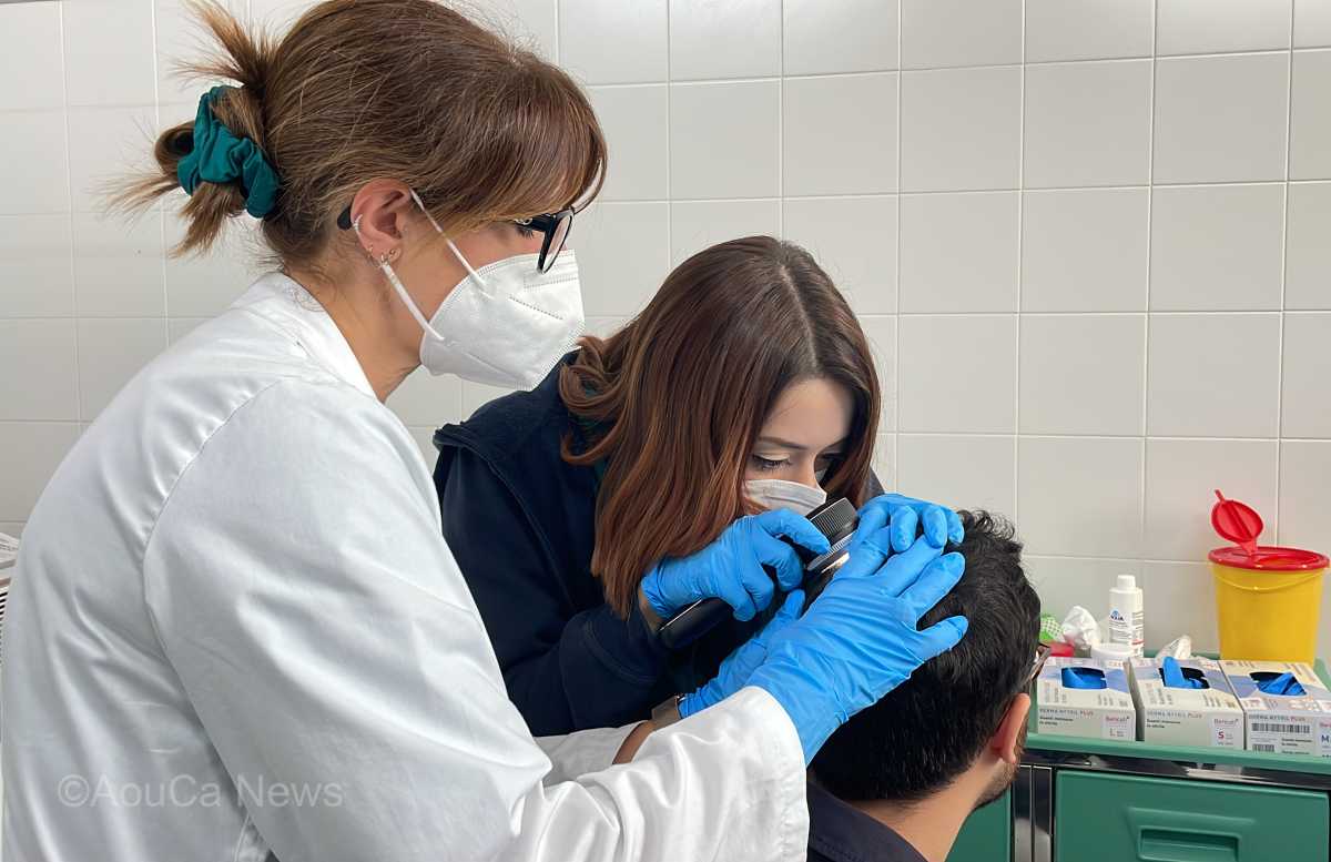 Dermatologia-Aou-CagliariVisita-Alopecia-areata